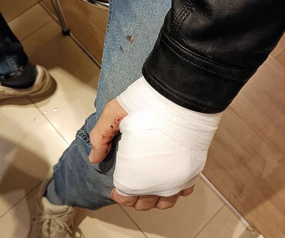 alt='Zaginiony 54-latek odnaleziony przez stra�nik�w miejskich'