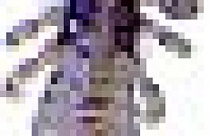 Wszawica w przedszkolach