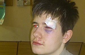 Autystyczne dziecko na Białołęce, gehenna rodzica