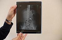 Fakir w tramwaju: połknął łańcuszek na oczach pasażerów