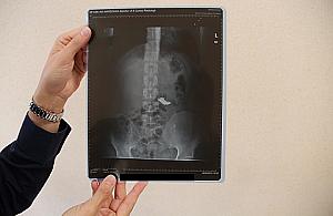 Fakir w tramwaju: połknął łańcuszek na oczach pasażerów