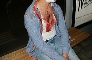 Mężczyzna raniony nożem w klubie. "Niczego nie pamięta"