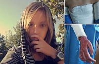 Pom�my poparzonej Zuzi z Niepor�tu