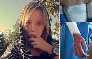 Pomóżmy poparzonej Zuzi z Nieporętu