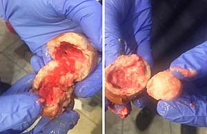 Seryjny truciciel psów? Trutkę wrzuca przez ogrodzenie