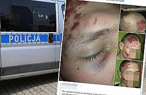 Akcja policji na Targówku. Kto kogo pobił?