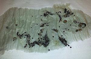 Jeden spacer - kilkadziesiąt kleszczy. Uważaj na psa