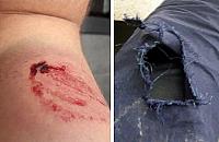 Interwencja na Chmielnej. Pogryziono strażnika miejskiego