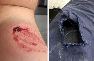 Interwencja na Chmielnej. Pogryziono strażnika miejskiego