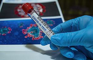 Koronawirus nie odpuszcza. 40 osób w szpitalu