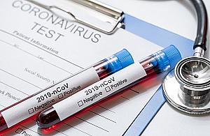 Bezpłatne testy na koronawirusa. Dwa punkty na terenie Bielan