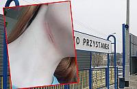 Trzech mężczyzn napadło na młodą kobietę. "Przyłożył mi nóż do gardła"
