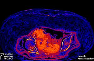 Tajemnica "ciężarnej mumii". Badają unikat z Muzeum Narodowego