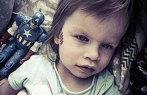 Czterolatka z Targówka potrzebuje pilnej pomocy