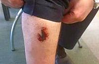 Pijany mężczyzna ugryzł strażnika miejskiego