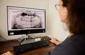 Implanty w Warszawie - gdzie najlepiej?