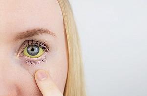 Zdążyć przed żółtym