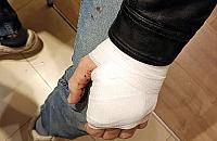 Zaginiony 54-latek odnaleziony przez strażników miejskich