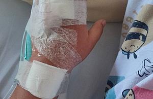 Wypadek i szycie rany u dziecka - czy ubezpieczenie NNW może zapewnić odszkodowanie?